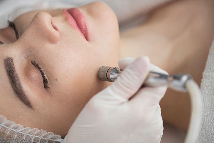 Microdermabrasion treatment